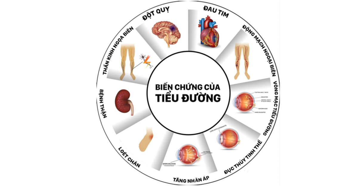 Bệnh đái tháo đường ảnh hưởng lên mắt như thế nào?